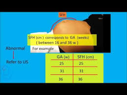 symphysis fundal height sfh measurement