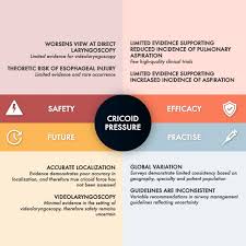 Image result for Rapid Sequence Induction