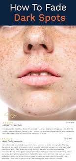 How To Fade Dark Spots How To Fade Beauty Skin Care Spots On Face