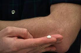 Image result for Dry Skin