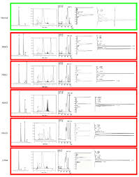 Universal Screening For Hemoglobinopathies In Todays Multi