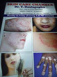 Elm skin clinics is the place for you. Top 10 Dermatologists In Khanapara Best Skin Specialists Book Appointment Online Justdial