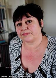 Woman, 54, left housebound after slipping