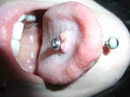 Maybe you would like to learn more about one of these? El Peligro De Los Piercing Orales Dental News Es
