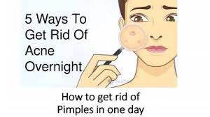Ppt – How To Get Rid Of Pimples In One Day Powerpoint Presentation | Free  To Download - Id: 8Ed0Fa-Ogi5N
