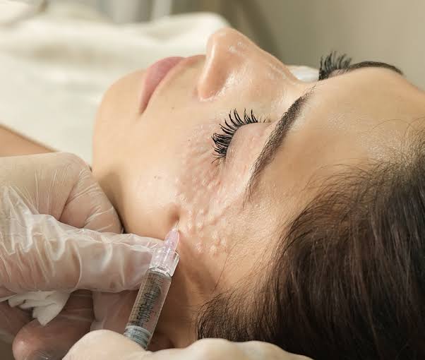 Skin Booster Treatment Dubai | Biorevitalization