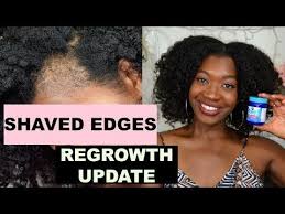 Shaved Off Edges To Grow Them Back Thicker Vicks Vapor Rub Week 4 Update Traction Alopecia 5 Youtube Grow Black Hair Vicks Vapor Rub Vicks Vapor