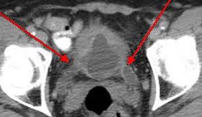 Genitourinary Radiology