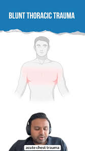 Image result for Chest Trauma