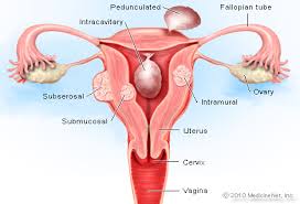 Level of l5, near transtubercular plane anatomy ileum, rectus abdominis muscle, ileocecal junction, cecum, internal abdominal oblique muscle, external abdominal oblique muscle. Illustration Picture Of The Pelvic Organs Intestines