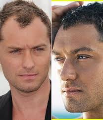 The receding hairline haircuts look exactly the same as the common ones, so nobody would ever have a clue that you have something to hide there. Mens Receding Hairline Hair Cuts Stylist225 Com Of Baton Rouge Salon Hair Stylist