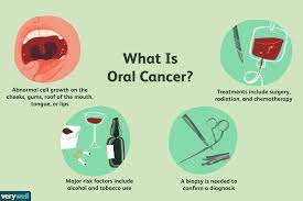 They are not liver cells that have become. Oral Cancer Overview And More