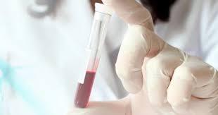 Shbg is found in all vertebrates apart from birds. Ø§Ø·Ù…Ù† Ø¹Ù„Ù‰ Ù†ÙØ³Ùƒ ØªØ­Ù„ÙŠÙ„ Shbg ÙŠÙ‚ÙŠØ³ Ø§Ø³ØªØ®Ø¯Ø§Ù… Ø§Ù„Ø¬Ø³Ù… Ù„Ù‡Ø±Ù…ÙˆÙ† Ø§Ù„ØªØ³ØªÙˆØ³ØªÙŠØ±ÙˆÙ† Ø§Ù„ÙŠÙˆÙ… Ø§Ù„Ø³Ø§Ø¨Ø¹