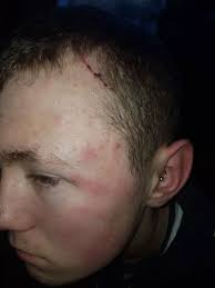 School issues statement after 'disgraceful' gang attack