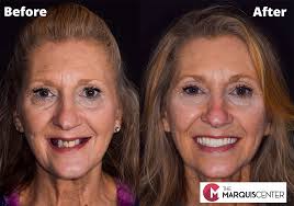 Dr. Patrick Waters, 13901 Parkway Commons Dr, Ste D, Oklahoma City, OK  73134, US