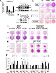 Many complex factors relate to the progression of diabetic nephropathy. The Aryl Hydrocarbon Receptor Is A Tumor Suppressor Like Gene In Glioblastoma Journal Of Biological Chemistry