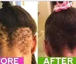 Stop Buying Fake Chebe Powder And Karkar Oil That Won T Work In Stock Is Your 10 Stop Buying Fake Thick Hair Remedies Regrow Hair Naturally Help Hair Loss
