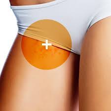 Anyone can get an ingrown hair. How To Prevent Ingrown Hair