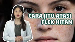 Cara menghilangkan flek hitam secara alami bisa dilakukan dengan produk rumahan atau dapur; Cara Menghilangkan Flek Hitam Secara Alami Dengan Cepat Youtube