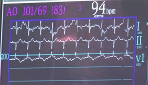 improving cath lab efficiency with todays hemodynamic