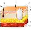 Your scalp is covered in hair follicles, tiny sacs from which each strand of hair grows. 1