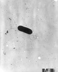 Under a microscope, the bacterium looks like the head of a comet with an actin tail trailing behind it. Listeria Wikipedia