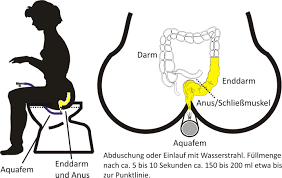 Hämorrhoiden können schmerzhaft sein, sie verschwinden aber meist ohne behandlung nach der geburt. Keine Angst Vor Verstopfung Und Harten Stuhl Mit Prokdus Hilfsmittel Onlineshop