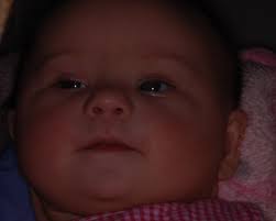 Brightest Future for Babies with Down Syndrome