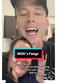 Machine Gun Kelly's Fangs Transformation