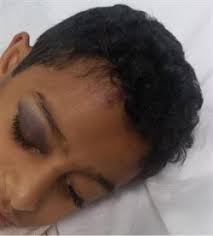 للمزيد من المعلومات حول اخبار تنسيق الثانوية العامة 2019 والحد الادنى للقبول يمكنك زيارة بوابة الحكومة الالكترونية المصرية موقع. Ø£Ø®Ø¨Ø§Ø± 24 Ø·Ø§Ù„Ø¨ Ø§Ø¨ØªØ¯Ø§Ø¦ÙŠØ© ÙÙŠ Ø§Ù„Ø·Ø§Ø¦Ù ÙŠØªØ¹Ø±Ø¶ Ù„ÙƒØ³Ø± ÙÙŠ Ø§Ù„Ø¬Ù…Ø¬Ù…Ø© Ø£Ø«Ù†Ø§Ø¡ Ø§Ù„ÙŠÙˆÙ… Ø§Ù„Ø¯Ø±Ø§Ø³ÙŠ Ùˆ Ø§Ù„ØªØ¹Ù„ÙŠÙ… ØªØ­Ù‚Ù‚