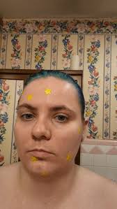 Do you use face stickers with salicylic acid to stop picking at your skin?