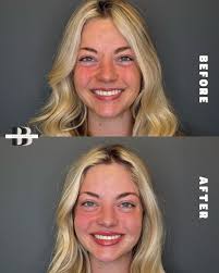 BAILEY BRUCE, MSN, FNP-C