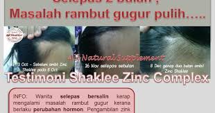 Masalah rambut gugur biasanya dilalui oleh semua golongan wanita mahupun lelaki. Ubat Rambut Gugur Selepas Bersalin Rawatan X