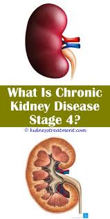 Pin On Kidney Health