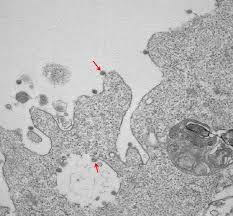 Bianco e nero è un motivo che si presenterà benissimo sia in versione colorata sia in quella monocromatica. Coronavirus Le Prime Foto Del Virus Isolato In Lombardia Tiscali Notizie