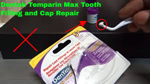 Temporary broken tooth repair kits are available in drugstores and online and can be helpful while waiting to see a dentist. How To Use Dentek Temparin Max Tooth Filling And Cap Repair Review Youtube
