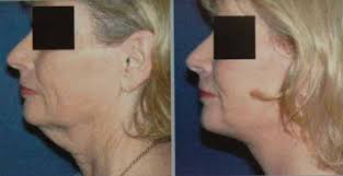 Carmel Pine Cone, February 19, 2010