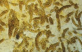 The dungeon is accessible via a door inside the large hollow tree. The Myxobacteria Springerlink