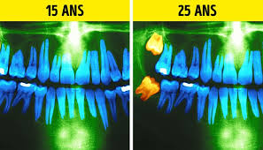 Nelly prystle viaja até a década de 40 e, devido a um acidente, não tem como voltar a seu próprio tempo. 26 Changements Dans Le Corps Humain Que Nous Verrons Inevitablement Au Fil Des Annees