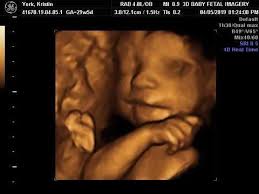 3D Baby Fetal Imagery