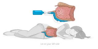 Plant cell walls make up much of the fibre that accumulates in your large intestines. Inflammatory Bowel Disease Gastrointestinal Society