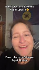 How Long Does Inguinal Hernia Repair Recovery Take