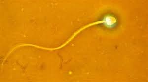 Semen Amarillo Sus Causas Y Que Hacer Para Solucionarlo