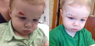 Viggo's cut: Before + After