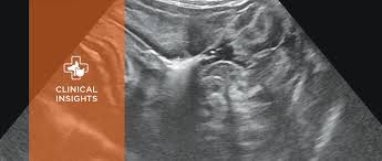 A cat ultrasound procedure usually proceeds as follows: Ultrasonography Of The Gastrointestinal Tract Stomach Duodenum And Jejunum Today S Veterinary Practice