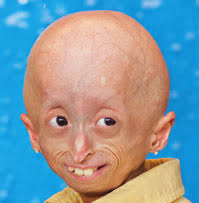 A Beautiful Life Proof Positive Mending Smiles Match Of A Lifetime