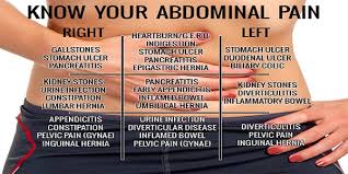 Stomach Pain Chart World Of Reference