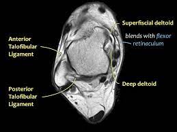 Mri Ankle Anatomy