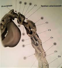 Der atlaswirbel ist der oberste halswirbel und stützt den kopf. Der Atlas Ursprung Vieler Probleme Pferdeosteopathie Tierheilpraxis Pferdefutterung