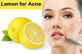 acne scars causes prevention